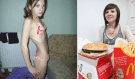 Anorektička jedla denně jenom 4 hrášky a vážila 25 kg, život jí zachránil až McDonald!