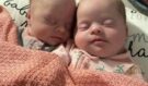 Žena porodila vzácná jednovaječná dvojčata s Downovým syndromem: Podívejte se, jak jsou roztomilá