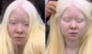 Neuvěřitelná proměna: Mladá albínská dívka se ukázala po přeměně a všechny nechala v úžasu