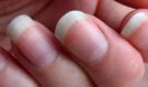 Neuvěříte, co mohou nehty odhalit o vašem zdraví! Podívejte se na těchto 11 varovných signálů, které nelze ignorovat