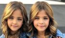 Nejkrásnější dvojčata na světě: Dnes jsou úžasná