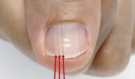 Co skutečně prozrazují svislé linky na nehtech?