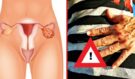 Tohle jsou 4 rané příznaky rakoviny vaječníků, které by každá žena měla znát