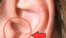 Chlupy v uších jako tiché varování srdce? Lékaři mají jasno, kdy už nejde jen o kosmetiku