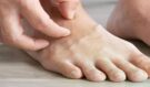 Varování jako příznak v nohou může signalizovat tři závažná onemocnění