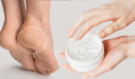 Dermatolog varuje: Popraskané paty jako tikající bomba. Jak se jich rychle zbavit bez drahé kosmetiky?