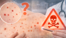 Máte na těle červené tečky? Dermatologové vysvětlují, kdy jde o banalitu a kdy už o varovný signál