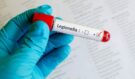 Legionella v Česku trhá smutné rekordy: Tichý zabiják z koupelen, hotelů i klimatizací?