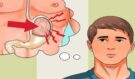 Nafouklé břicho a věčný pocit plnosti? Skrytý zabiják v žaludku může být nebezpečnější, než si myslíte