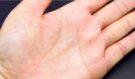 Tělo volá o pomoc: 5 varovných signálů, že vám zoufale chybí vitamín C