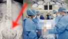 Lékaři zůstali v šoku: Co v těle ženy zanechal její vlastní manžel?