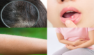 Lupiny, afty, husí kůže i zácpa: Nenápadné varování, že vašemu tělu zoufale chybí vitaminy. Poznáte je včas?