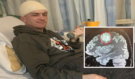 Osm let s nádorem v hlavě. Mladík ignoroval varovné signály, protože „jen moc pracoval“