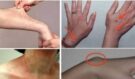 Tělo křičí o pomoc dřív, než skolí nemoc: Varovné signály na kůži, které se nevyplácí přehlížet