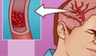 Tělo volá o pomoc: 12 nenápadných signálů, že vám dlouhodobě chybí hořčík. Poznáte je včas?