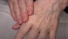 Rakovina kostí může začít nenápadně: Tohle jsou první varovné příznaky, se kterými musíte okamžitě k lékaři!
