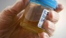 Domácí „přírodní antibiotikum“ na zánět močových cest? Tento recept koluje internetem, lékaři ale varují před riziky