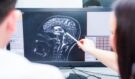 Parkinson nemusí začít třesem: 4 nenápadné signály, které lidé roky přehlížejí (a mohou se objevit i 20 let před diagnózou)