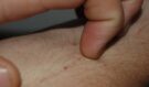 Tělo často varuje dříve, než je pozdě: 15 nenápadných signálů, které lidé přehlížejí – a mohou souviset i s rakovinou