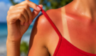 Spálili jste se na slunci? Dermatologové varují Tuhle chybu nikdy nedělejte