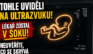 Anděl na ultrazvuku? Těhotná žena zůstala v šoku, snímek její dcery vyrazil dech i lékaři