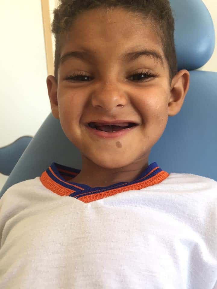 1: Malý chlapec žil 3 roky bez zubů, pak mu pomohla paní zubařka: Jakmile se uviděl v zrcadle, rozzářil se štěstím!